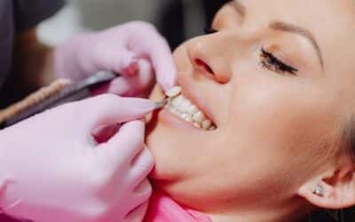 ¿Qué son las carillas dentales? Ventajas y desventajas