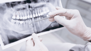 Rayos x tratamiento ortodoncia