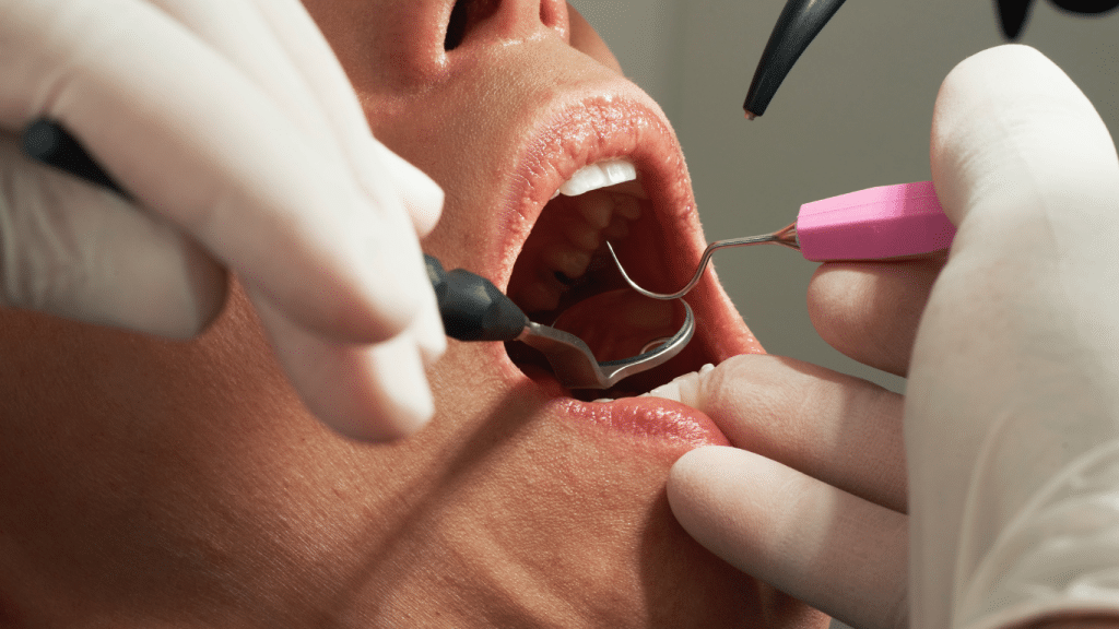 paciente profilaxis dental